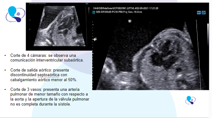 caso clinico medicina materno fetal 1.4