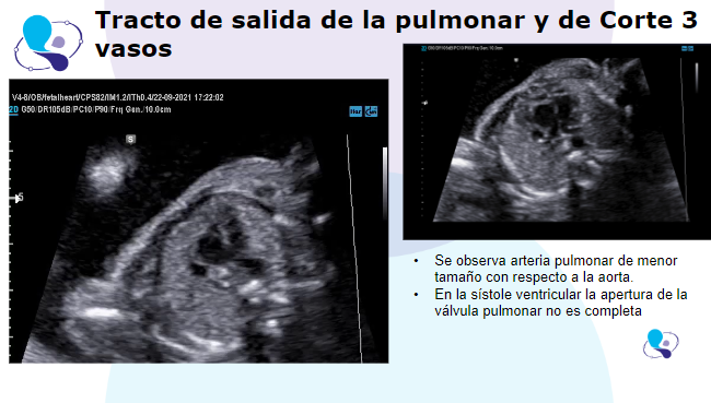 caso clinico medicina materno fetal 1.5