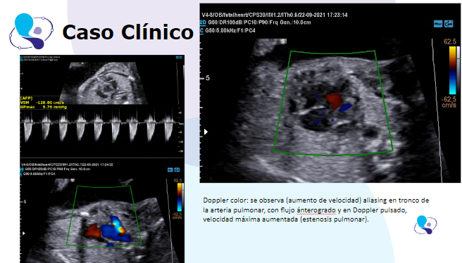 caso clinico medicina materno fetal 1.6