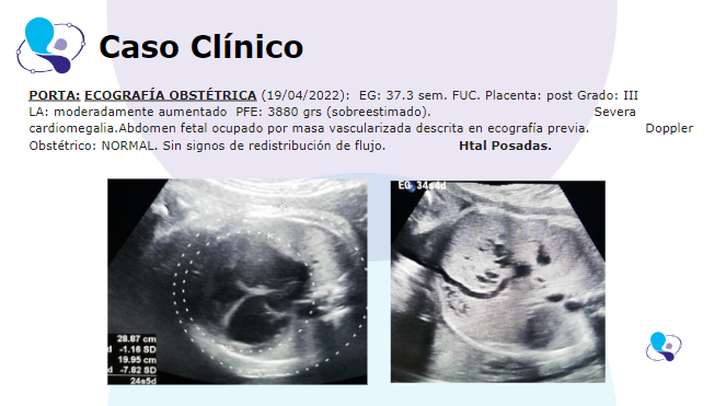 caso clinico medicina materno fetal 3