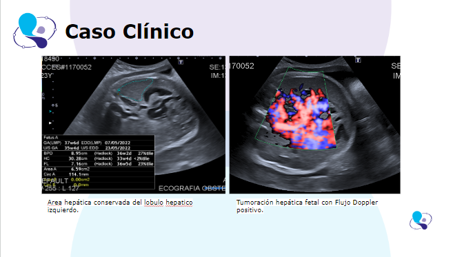 caso clinico medicina materno fetal 5