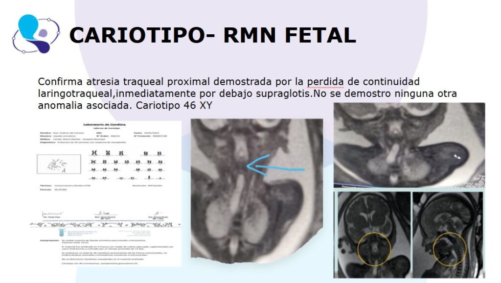 CHAOS CASO CLINICO MEDICINA MATERNO FETAL ARGENTINA5