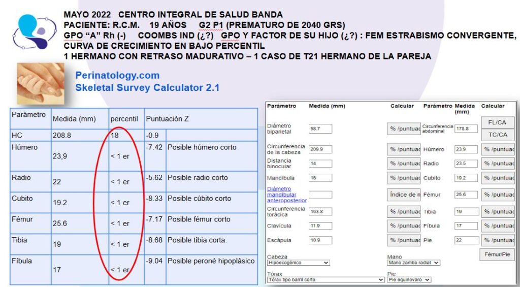 Dispalsia esqueleticia medicina materno fetal argentina1